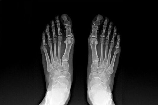 Que dit vraiment la science sur les séparateurs d’orteils (et en quoi cela concerne Orteya)